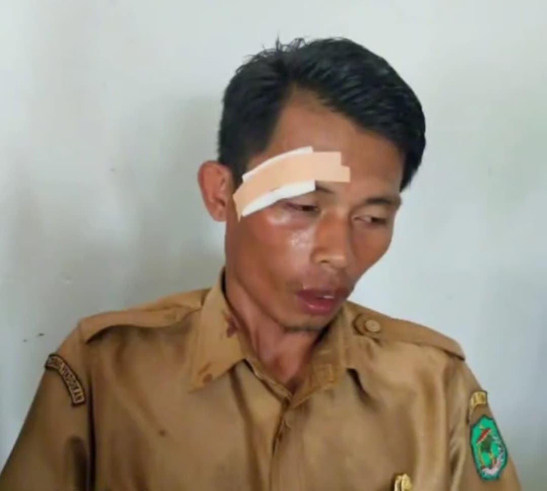 Guru Arpan Lisman (28) Dianiaya Oleh Seorang Siswa Saat Menegur Aksi Bolos di Jam Pelajaran di SMP Negeri 1 Baebunta Selatan, Kabupaten Luwu Utara, Sulawesi Selatan