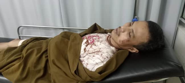 Parahhh!!! Oknum Preman dan Eks Kades di Cariu Aniaya Dua Warga Sukarasa